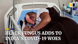 The black fungus nightmare facing India’s coronavirus patients