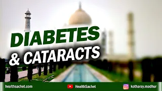 How DIABETES Leads to Development of Cataracts!