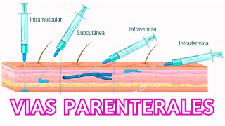 Generalidades vías parenterales/ Cofia Educativa