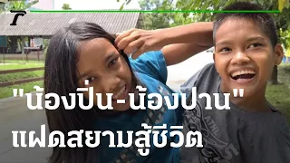 "น้องปิ่น - น้องปาน" แฝดสยามสู้ชีวิต | 27-08-65 | ไทยรัฐนิวส์โชว์