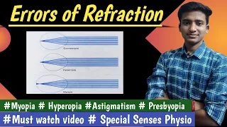 Errors Of Refraction || Myopia || Hypermetropia|| Special Senses ||Physiology || By Ashish Agrawal