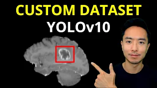 YOLOv10 Custom Dataset Training Object Detection Brain Tumors