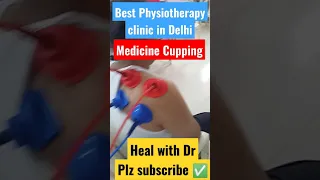Medicine cupping therapy for back pain permanent relief #backache #cupping #physiotherapy