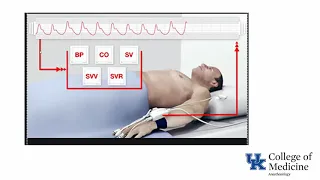 BP Monitoring (invasive, non-invasive, pulse pressure variation, phys) (Dr. Hessel)