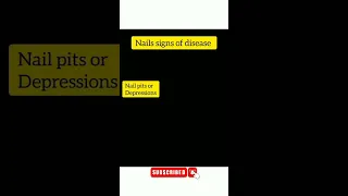 Nail signs of Disease | Nail pitting | Finger clubbing | Signs of anemia |     #nails #medical #mbbs