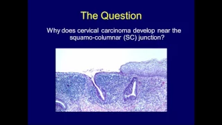 LMP Grand Rounds CCrum 24May2017