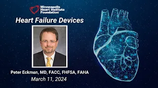 Heart Failure Devices | Peter Eckman, MD, FACC, FHFSA, FAHA