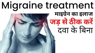 Migraine ka ilaj | Migraine treatment at home in Hindi