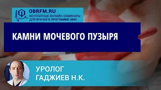 Уролог Гаджиев Н.К.: Камни мочевого пузыря