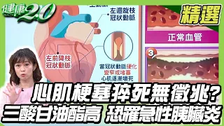 明金成心肌梗塞猝死無徵兆？98歲常楓睡夢中猝死真相？血管塞了嗎？看頸動脈就知道！三酸甘油酯比膽固醇可怕！清血管這樣吃！【健康2.0精選】