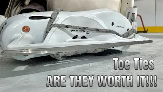 Toe Ties | Are They WORTH It