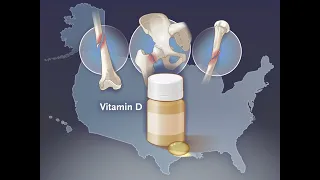 Vitamin D and Fracture Risk among Adults | NEJM