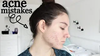 10 SKINCARE MISTAKES YOU'RE MAKING THAT MAKE YOUR ACNE WORSE !