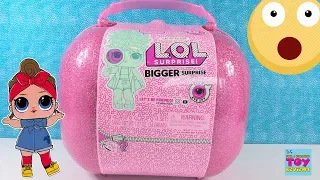 LOL Bigger Surprise Limited Edition Doll Unboxing 60 Surprises Inside | PSToyReviews