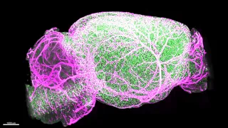 Mouse brain stained for amyloid plaques (green) and arteries (magenta).