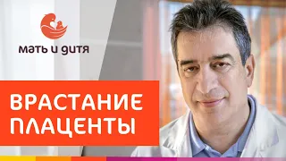 🤰 Сохранение матки, роды при врастании плаценты в КГ Лапино. Врастание плаценты. 18+