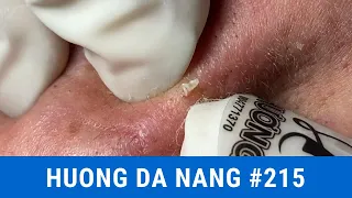#215 | Huong Da Nang