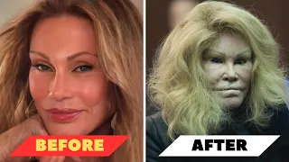 Celebrities botched plastic surgery: Before And After❗😱