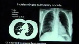 Chestx - ray reading Dr . Mamdouh Mahfouz