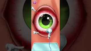 Eye operation Doctor 🫀#Shorts#androidgames#iosgaming#gaming