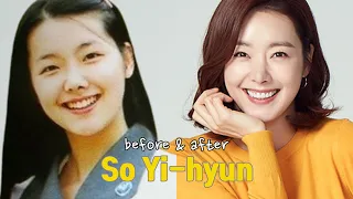 So Yi-hyun before and after