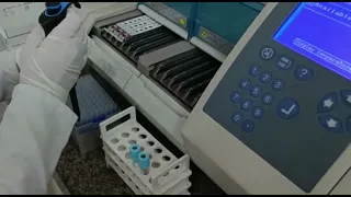 D - dimer test on Mini Vidas |Biochemistry