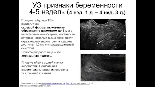 Ультразвуковые признаки беременности 4-5  недель2022 05 03 14 04 09