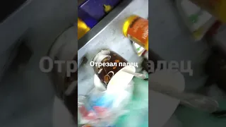 канцелярским ножом отрезал палец