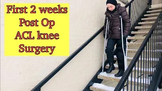 ACL knee surgery recovery / First 2 weeks Post Op