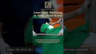 Laser Teeth Whitening in Seoul, South Korea | Seoul Guide Medical