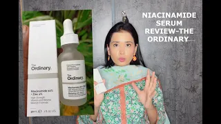 DETAILED REVIEW on The ordinary Niacinamide and zinc serum-IN Urdu/Hindi- results, price, use etc