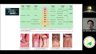 Hacks in Pediatric Urology