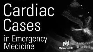 Cardiac Cases in Emergency Medicine