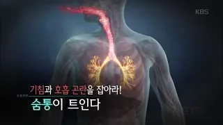 생로병사의 비밀 - 기침과 호흡 곤란을 잡아라! 숨통이 트인다.20180620