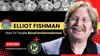 RENAL INCIDENTALOMAS | DR ELLIOT FISHMAN #renaltumors #incidentalomas #ctbuzz