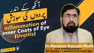 Uveitis | Inflammation of Inner Coats of Eye