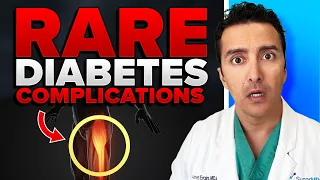 A Devastating Diabetes Complication Hits Him!