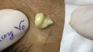 Satisfying video with Chung Vo Spa #137