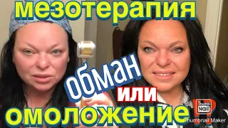 МЕЗОРОЛЛЕР домашнее применение ‼️