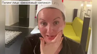 Феноловый пилинг . Жёлтый пилинг (ретиноловый ) Sesderma by mediderma