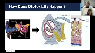 Ototoxic Medications with Guest Speaker Dr. Morgan Selleck, MD and Caitlyn Whitson, Au.D.