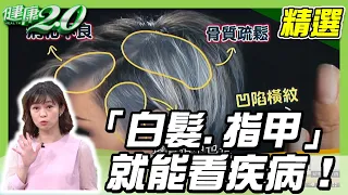 身體好不好「白髮、指甲」就能看疾病！改善白髮這樣做【@tvbshealth20 精選】