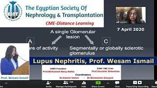 Lupus nephritis  Prof  Wesam Ismail, 7 April 2020