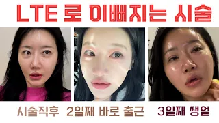 ENG🍋바쁜 현대인들을 위한 초고속 피부과 관리 꿀팁 (feat.이뻐졌다는 소리 많이 들으면 내덕 이뻐진건 니덕)