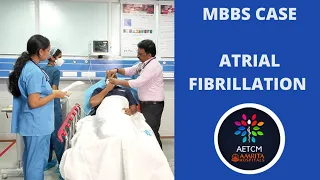 MBBS Case Discussion || Atrial Fibrillation || Heart Failure