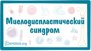 Миелодиспластический синдром (МДС) — причины, симптомы, патогенез, диагностика, лечение