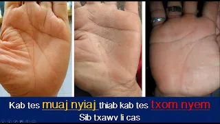 Kab tes Muaj Nyiaj thiab kab tes Txom Nyem sib txawv li cas?