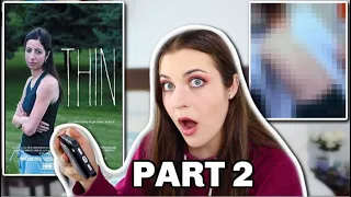 Anorexia Recovered Girl Reacts to the Documentary THIN Part 2