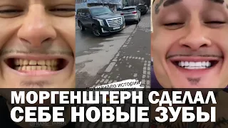 Моргенштерн сделал себе новые зубы за 2 миллиона рублей