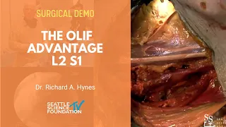 Live Demo: The OLIF Advantage L2 S1 - Richard A. Hynes, MD